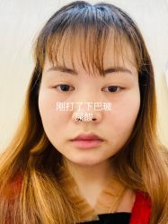 体验后-成都艾特他整形外科医院