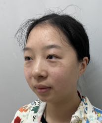 -天津健丽·去眼袋医疗美容机构