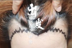 -大麦微针植发全国连锁