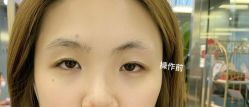 -MISS STAR·半永久纹眉·发际线·美瞳线