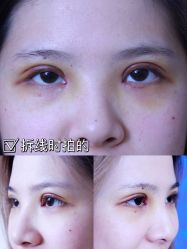 -深圳阳光医疗美容