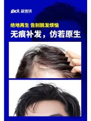 点击看大图 -极客侠男士假发定制补发