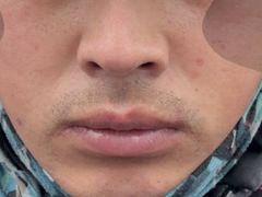 -东南大学附属中大医院(本部)