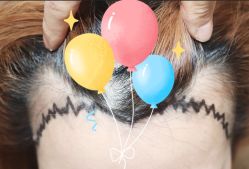 -大麦微针植发全国连锁