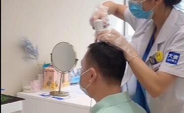 -大麦微针植发丨全国连锁