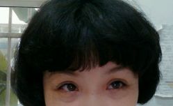 点击看大图 -依萱绮医疗美容