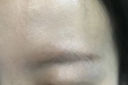 -郡艺医疗美容·微整·眼鼻吸脂