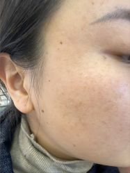 -长沙雅美医疗美容医院