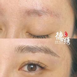 -德绣·机器野生眉发际线·美瞳线半永久