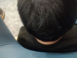 -碧莲盛·不剃发植发