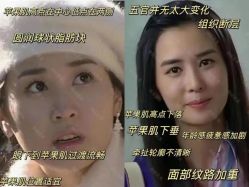-倩极·精研痘敏肌管理