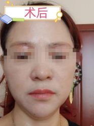 -素美医疗美容·西南眼鼻整形·修复基地