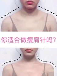 -上海漾颜医疗美容