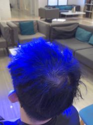 -雍禾植发全国连锁