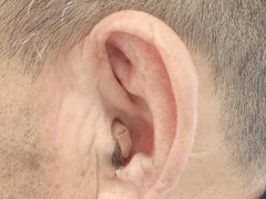 -安湃声助听器(密云店)