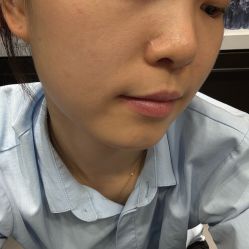 -广州紫馨整形外科医院