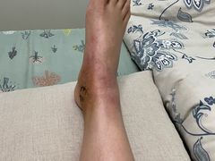 -成都市第一人民医院(南区)