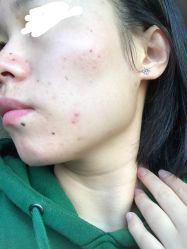 -皇族养心堂·净痘·修敏·御颜
