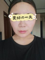 -成都西区医院整形美容