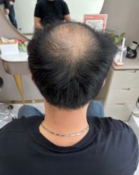 -唐风采假发补发定制