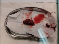 -宁波大学附属第一医院(外滩院区)