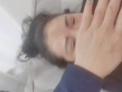 -莲姿娜半永久纹眉皮肤管理