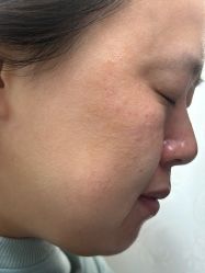 -长沙雅美医疗美容医院