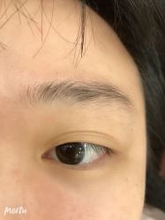 -伊丽莎白医疗美容