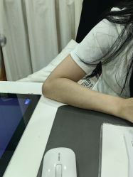 体验前-悟空祛痘·诺奖技术专业店