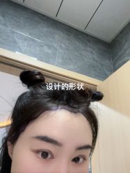 -碧莲盛·不剃发植发
