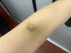 -上海市第八人民医院-体检中心