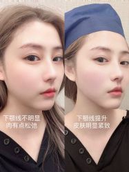 -针美汇欧邦医疗美容