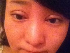 第四天-上海华安整形外科门诊部