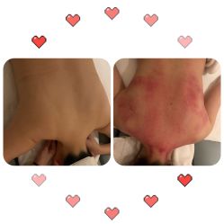 -安吉拉青春化管理中心