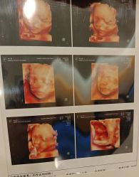 -杭州贝瑞斯美华妇儿医院·早孕·产检·儿科