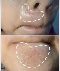 -美肤盾祛痘·问题肌头疗管理中心