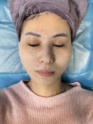 -南宁维密整形·王敦华眼鼻整复中心