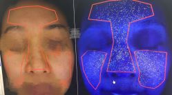 -安那般那皮肤年轻化ANAPANA