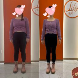 -Lily纤美·科技减脂中心