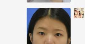 -天津健丽·去眼袋医疗美容机构