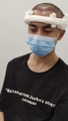 -大麦微针植发全国连锁