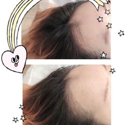 -西施无菌半永久纹绣眉眼影唇轻增发纹发际线