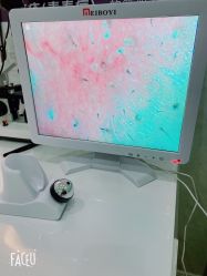 -苗方清颜专业祛痘