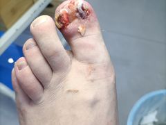 -世龙世家甲沟炎·灰指甲·嵌甲矫正·修脚(武侯区双楠店)