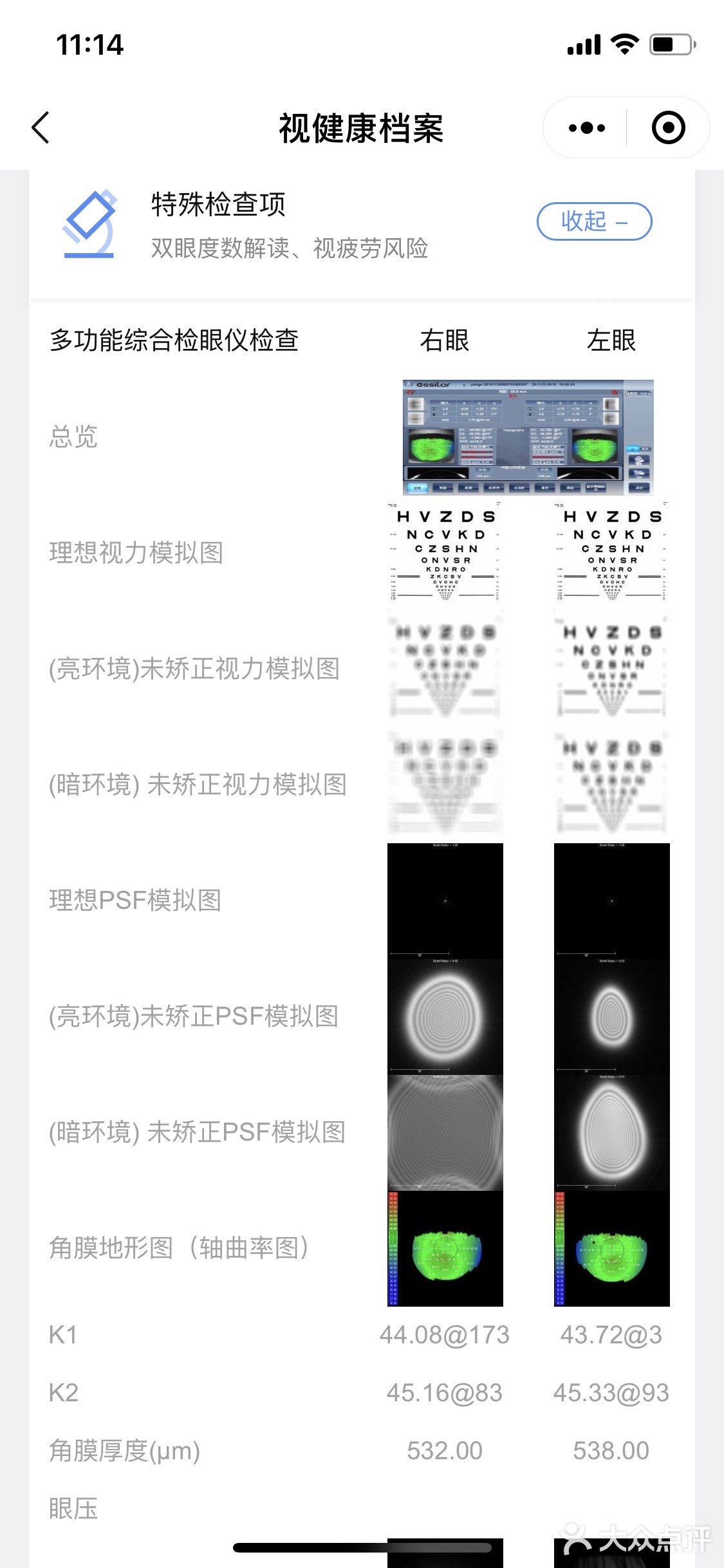 青少年360°近视防控