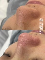 -skin79皮肤管理中心