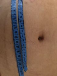 -肥三针腧穴瘦身馆