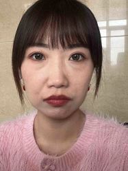 -Yestar 嘉兴艺星医疗美容医院