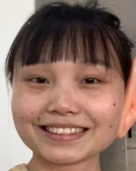 体验前-深圳鹏爱悦心医疗美容医院
