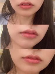 体验后-美莱医疗美容医院